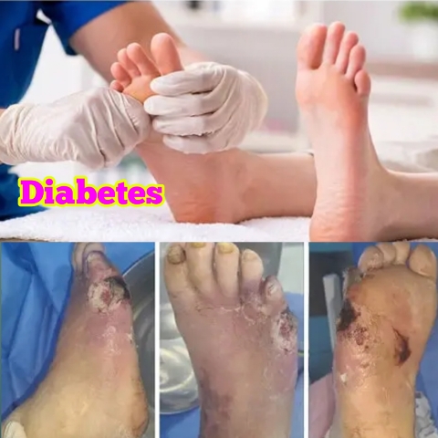 diabetic footwear for men